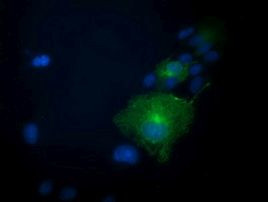 PRKAR1B Antibody in Immunocytochemistry (ICC/IF)