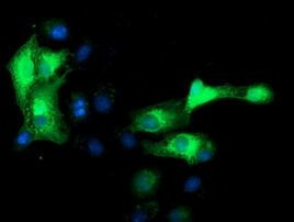 MAPRE2 Antibody in Immunocytochemistry (ICC/IF)