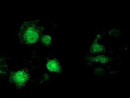 MAPRE2 Antibody in Immunocytochemistry (ICC/IF)