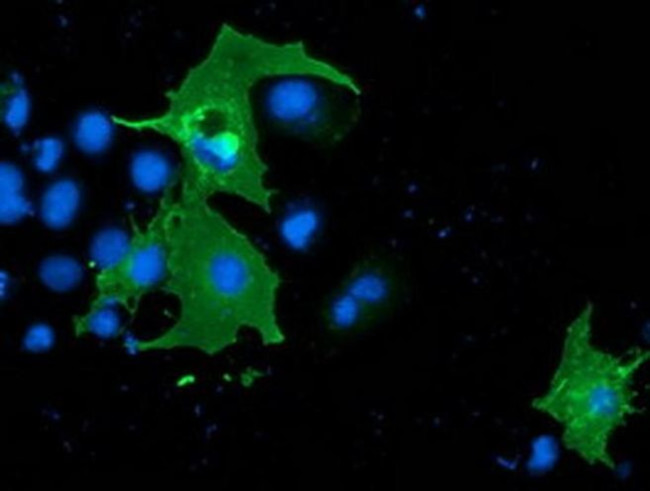 LNK Antibody in Immunocytochemistry (ICC/IF)