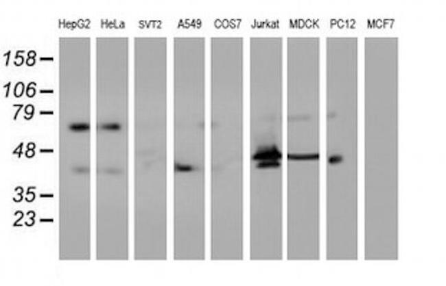 ITFG2 Antibody in Western Blot (WB)
