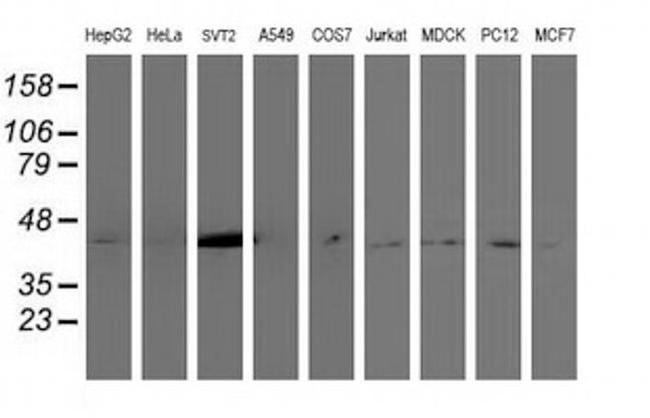 Nudel Antibody in Western Blot (WB)