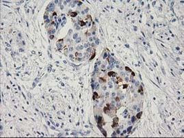 RGS5 Antibody in Immunohistochemistry (Paraffin) (IHC (P))