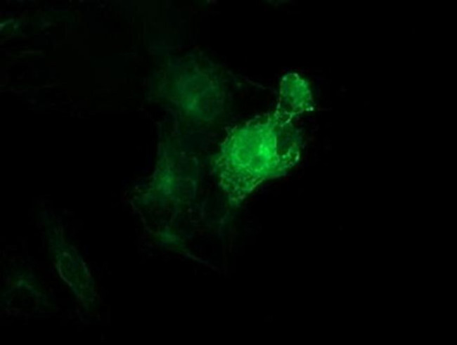 beta-4 Tubulin Antibody in Immunocytochemistry (ICC/IF)