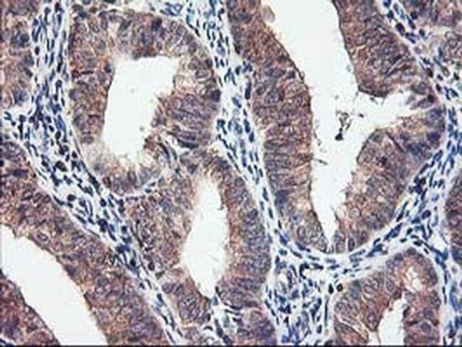PBDC1 Antibody in Immunohistochemistry (Paraffin) (IHC (P))