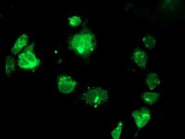TRAP alpha Antibody in Immunocytochemistry (ICC/IF)