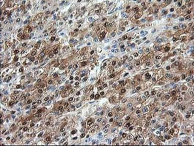 Aminoacylase Antibody in Immunohistochemistry (Paraffin) (IHC (P))