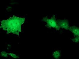 TOMM34 Antibody in Immunocytochemistry (ICC/IF)