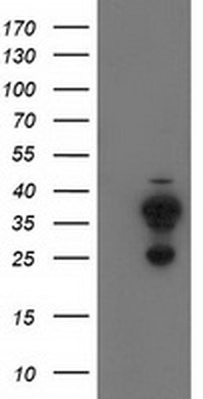 CYB5R2 Antibody in Western Blot (WB)