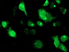 TRAP alpha Antibody in Immunocytochemistry (ICC/IF)