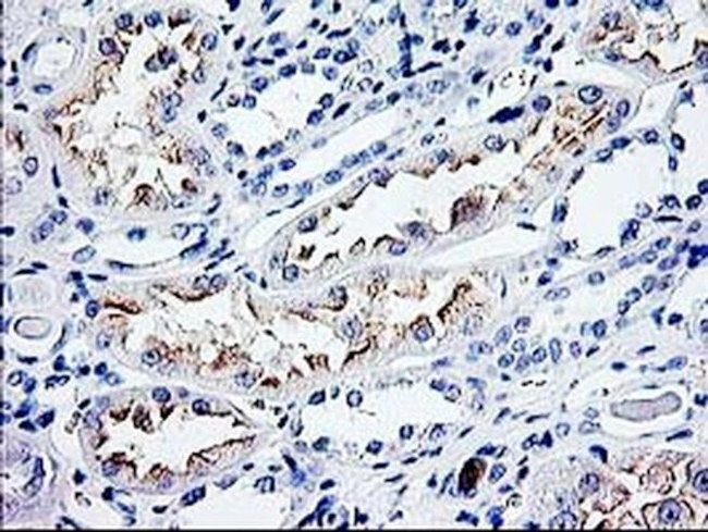 CDKN3 Antibody in Immunohistochemistry (Paraffin) (IHC (P))