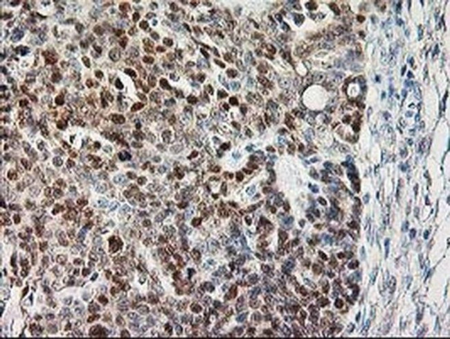 Calpain 9 Antibody in Immunohistochemistry (Paraffin) (IHC (P))