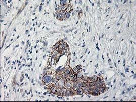 APBB3 Antibody in Immunohistochemistry (Paraffin) (IHC (P))
