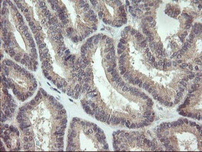 KRTAP2-4 Antibody in Immunohistochemistry (Paraffin) (IHC (P))