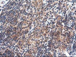 TRK fused gene Antibody in Immunohistochemistry (Paraffin) (IHC (P))
