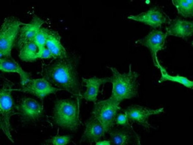 TUBAL3 Antibody in Immunocytochemistry (ICC/IF)