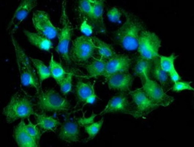 TUBAL3 Antibody in Immunocytochemistry (ICC/IF)