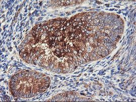 PFKP Antibody in Immunohistochemistry (Paraffin) (IHC (P))