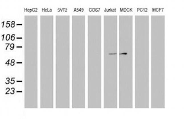 FBXO31 Antibody in Western Blot (WB)