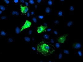 FBXO21 Antibody in Immunocytochemistry (ICC/IF)