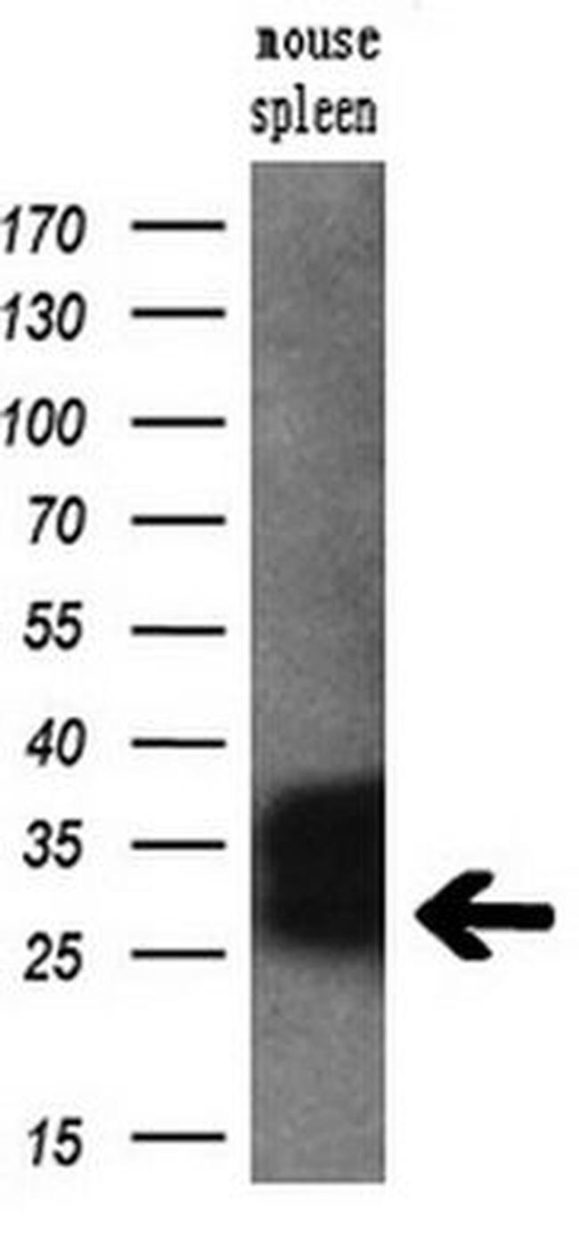 RGS16 Antibody in Western Blot (WB)