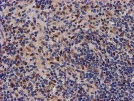 MKRN1 Antibody in Immunohistochemistry (Paraffin) (IHC (P))