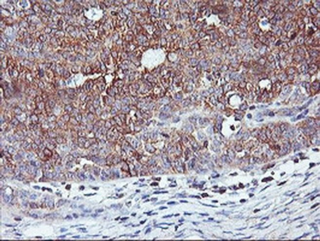PFDN6 Antibody in Immunohistochemistry (Paraffin) (IHC (P))