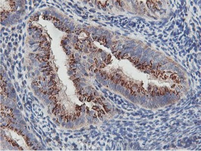 NMT2 Antibody in Immunohistochemistry (Paraffin) (IHC (P))
