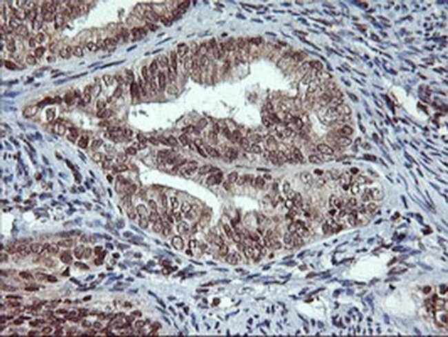 TPSG1 Antibody in Immunohistochemistry (Paraffin) (IHC (P))