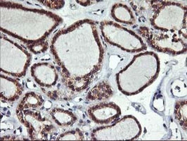 ALG2 Antibody in Immunohistochemistry (Paraffin) (IHC (P))