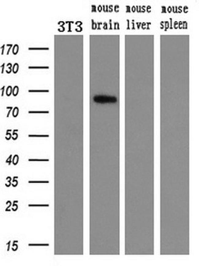 ALOX15 Antibody in Western Blot (WB)