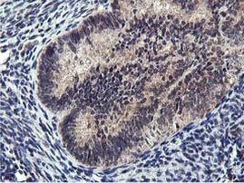 MIER2 Antibody in Immunohistochemistry (Paraffin) (IHC (P))