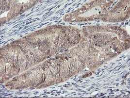 MAOA Antibody in Immunohistochemistry (Paraffin) (IHC (P))
