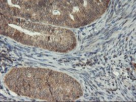 MAOA Antibody in Immunohistochemistry (Paraffin) (IHC (P))
