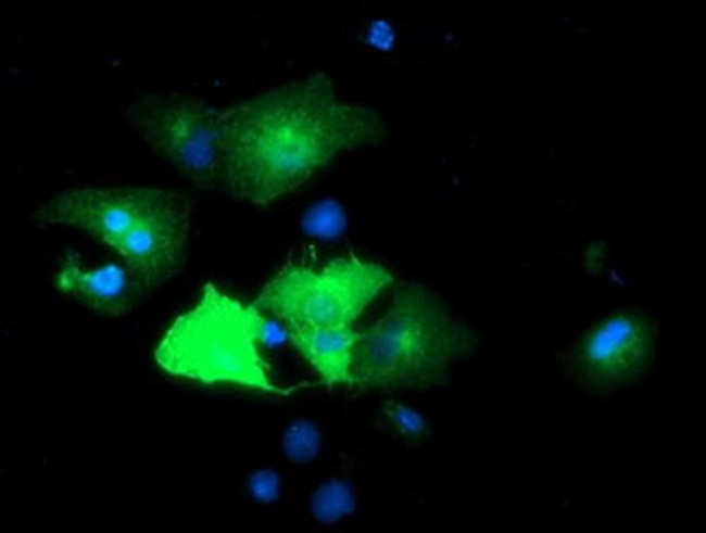 Epsin 2 Antibody in Immunocytochemistry (ICC/IF)