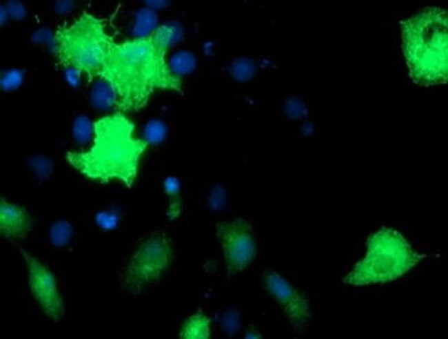 Epsin 2 Antibody in Immunocytochemistry (ICC/IF)