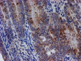 SPATC1L Antibody in Immunohistochemistry (Paraffin) (IHC (P))