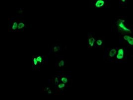 RUNX1T1 Antibody in Immunocytochemistry (ICC/IF)