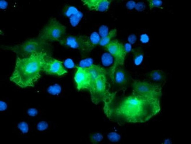 RFPL3 Antibody in Immunocytochemistry (ICC/IF)