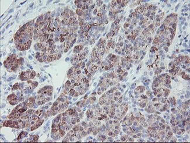 PPIL6 Antibody in Immunohistochemistry (Paraffin) (IHC (P))