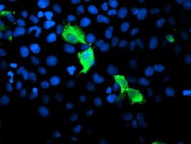 GIMAP4 Antibody in Immunocytochemistry (ICC/IF)