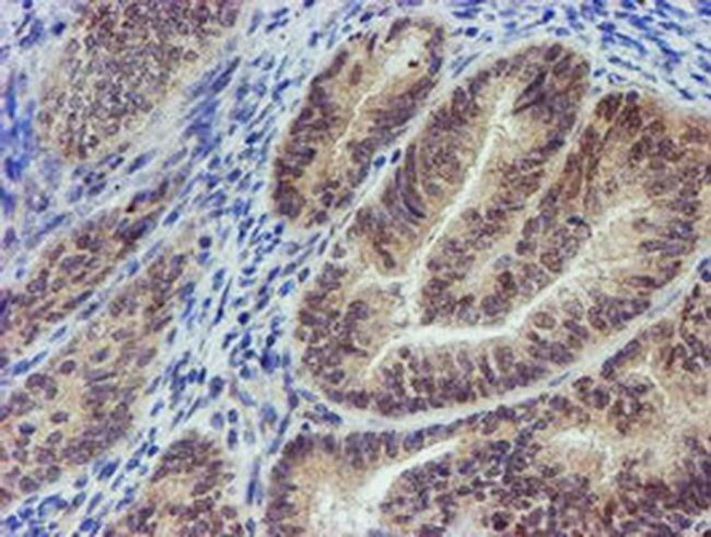 MLF2 Antibody in Immunohistochemistry (Paraffin) (IHC (P))