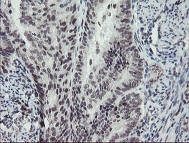 MLF2 Antibody in Immunohistochemistry (Paraffin) (IHC (P))