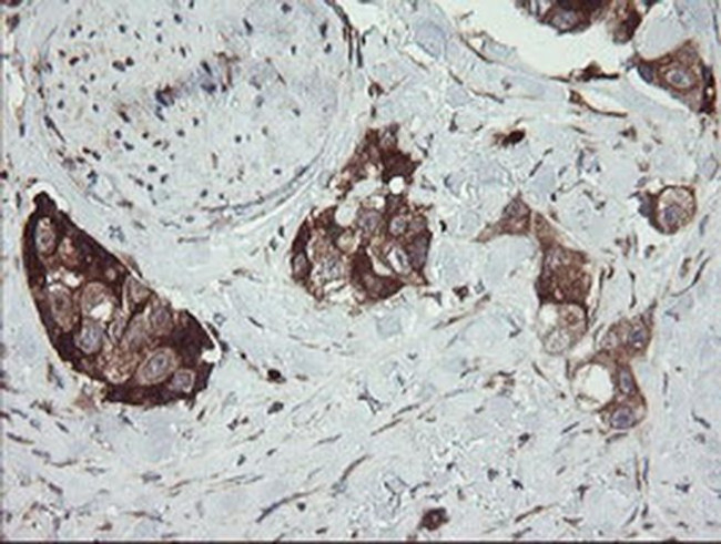 TPD52L3 Antibody in Immunohistochemistry (Paraffin) (IHC (P))