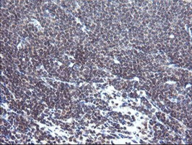 TPD52L3 Antibody in Immunohistochemistry (Paraffin) (IHC (P))
