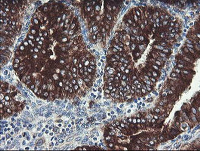TPD52L3 Antibody in Immunohistochemistry (Paraffin) (IHC (P))