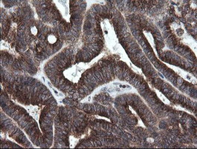 GORAB Antibody in Immunohistochemistry (Paraffin) (IHC (P))