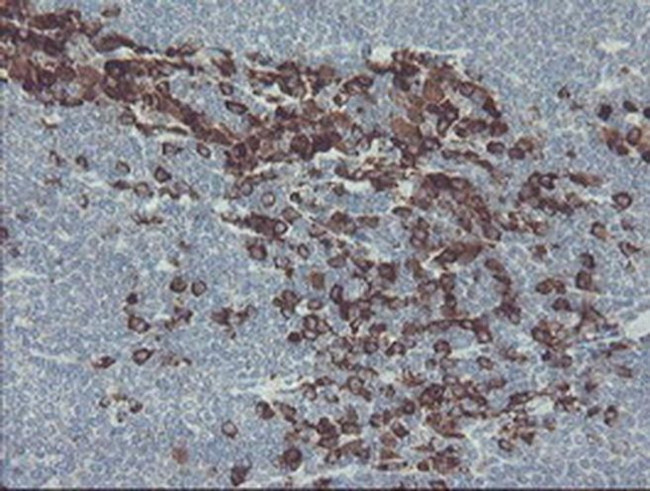 GORAB Antibody in Immunohistochemistry (Paraffin) (IHC (P))