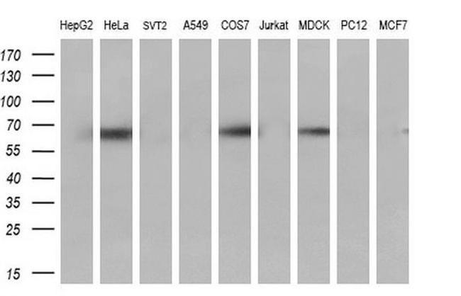 CBLC Antibody in Western Blot (WB)