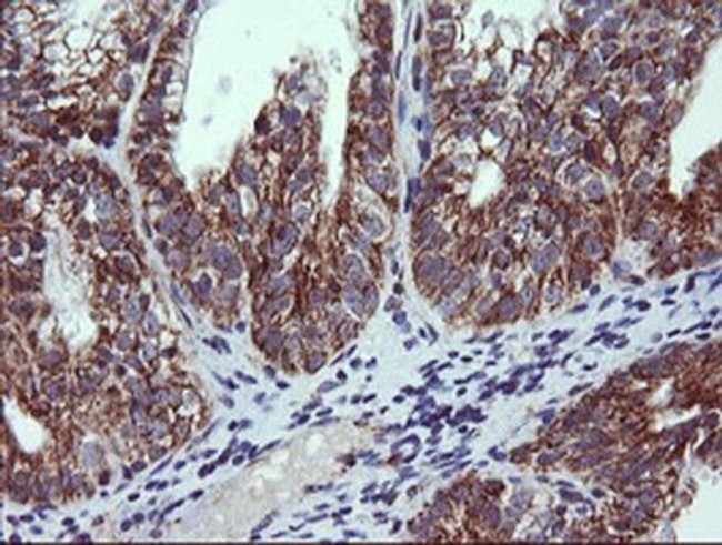 NDUFB10 Antibody in Immunohistochemistry (Paraffin) (IHC (P))